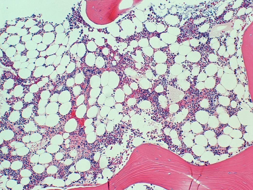 Figure 4. Trephine bone marrow biopsy section, 4x